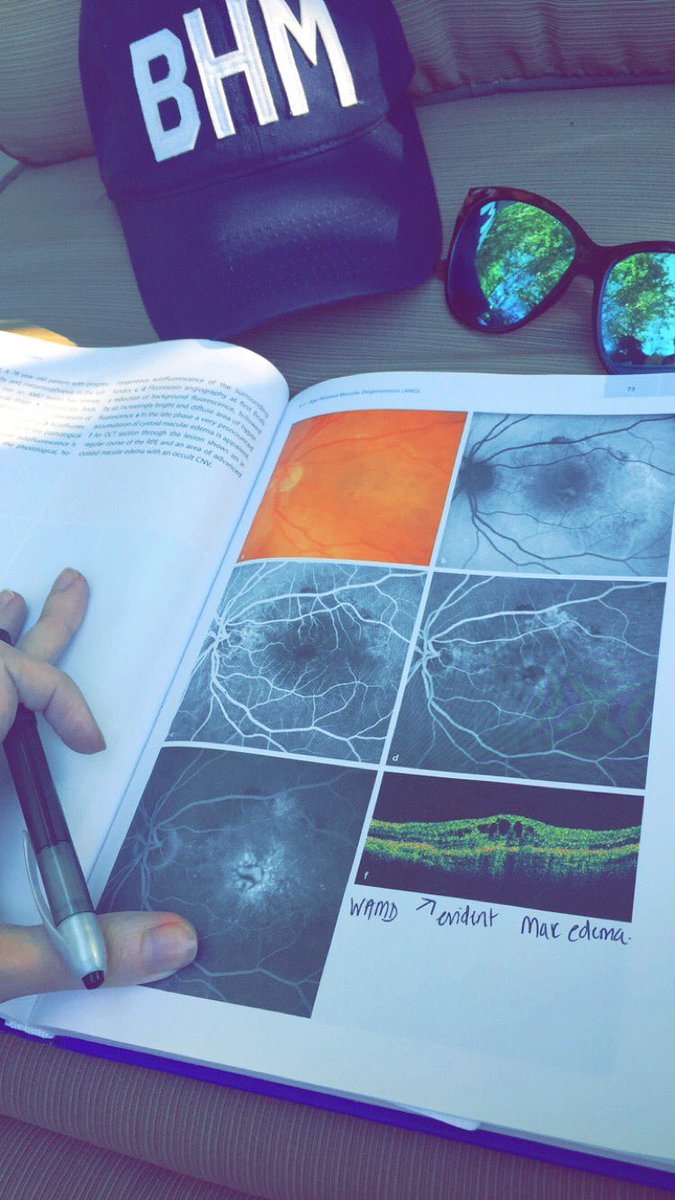 ashtonm2's tweet photo. Backyard study vibes! #Avondale #ClubMixer #Aviate #Eyesarecomplicated @aviatebrand https://t.co/yuOVhwoja1