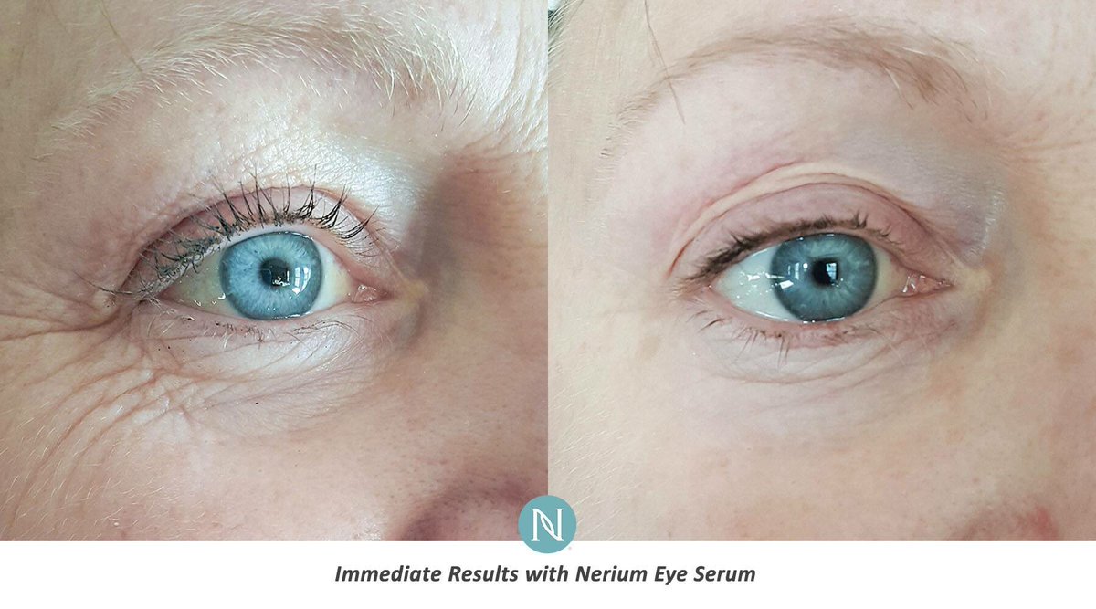 GetEcigsFree's tweet image. Frigg'n amazing product #vapers. Eye Serum! Results in minutes not days. Visit my sista at WhatIsNeriumAD.com.