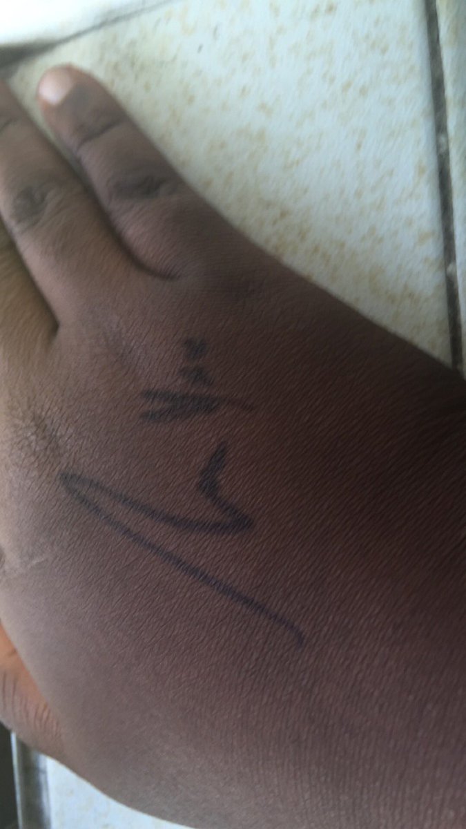 Anastasia_slays's tweet photo. @JackBrettTaylor Thanks for signing my hand thou 👍😂 don't remember which one is yours thou! @EbenOfficial https://t.co/DWZfRzMV6L