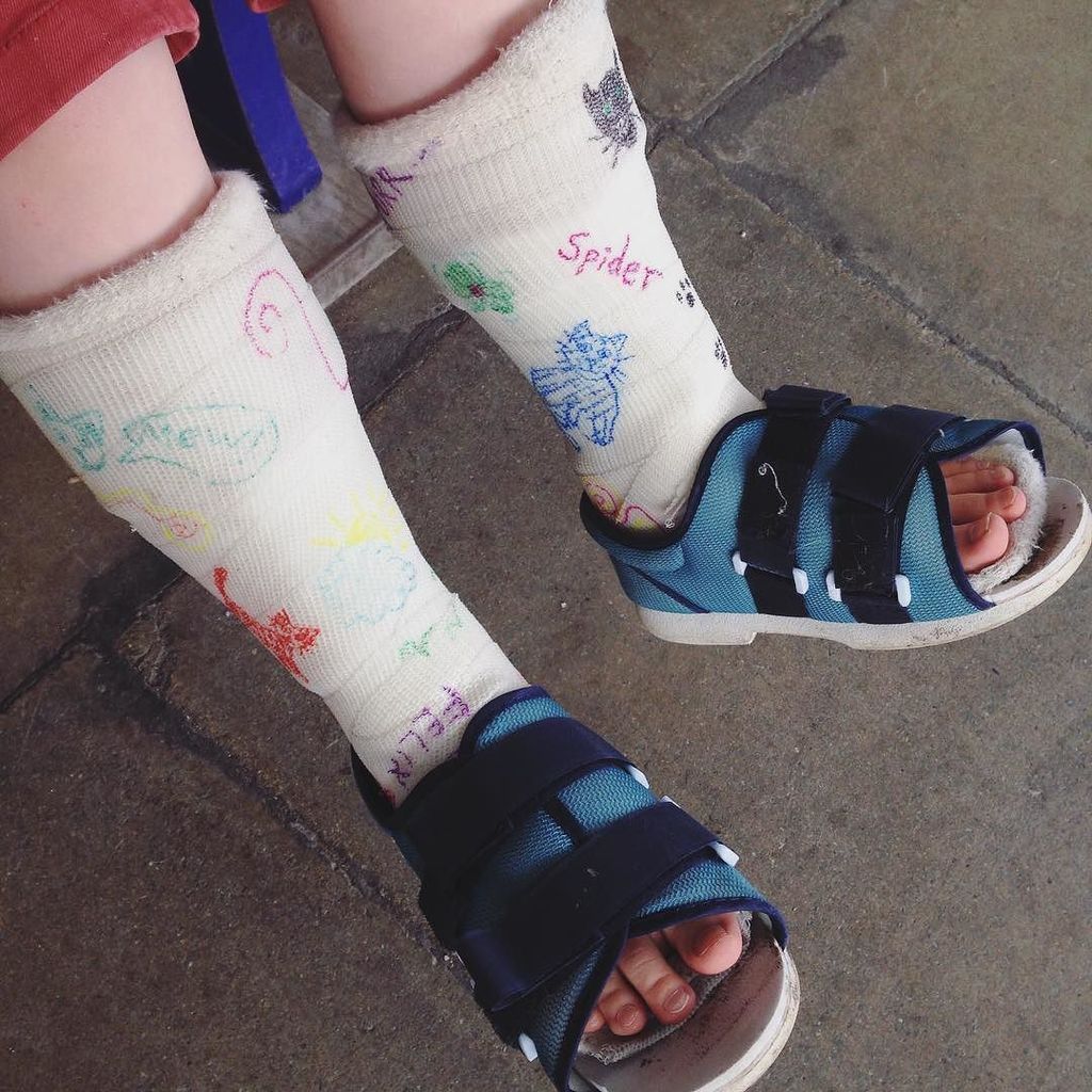 special shoes for tip toe walkers