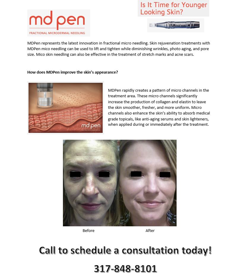 TurkleMD's tweet photo. Can I borrow your pen? Sign away your signs of aging with MD Pen! #phases #turkle #harper #beauty #mdpen https://t.co/CtEKK1ie9e