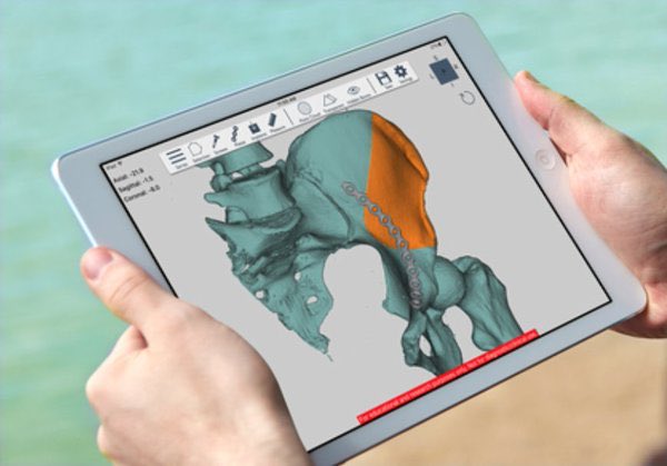 Conceptualiz_'s tweet photo. Complete #creative #freedom for #3dplanning and #3dprinting in #orthopedics #JECWorld2016 JECWorld2016 https://t.co/6omftjMWG1