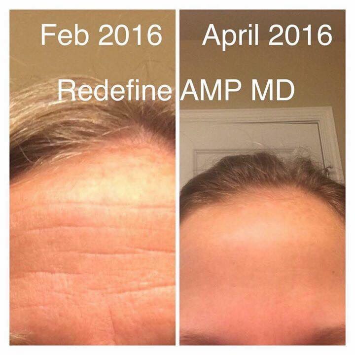 kimberlyvanzee's tweet photo. #Redefine what your looks like. Message me &amp; let's talk about how you can get started to the best skin of your life! https://t.co/9mVcM1QWJv