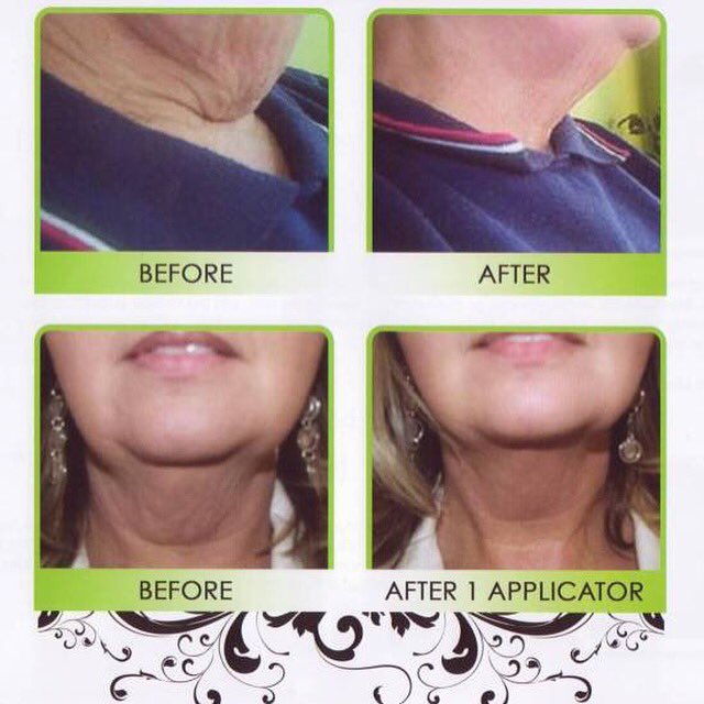 "the wraps are making my stretch marks look better - and they've been there for 30 years."  THATS HUGE!! 👏🏻👏🏻