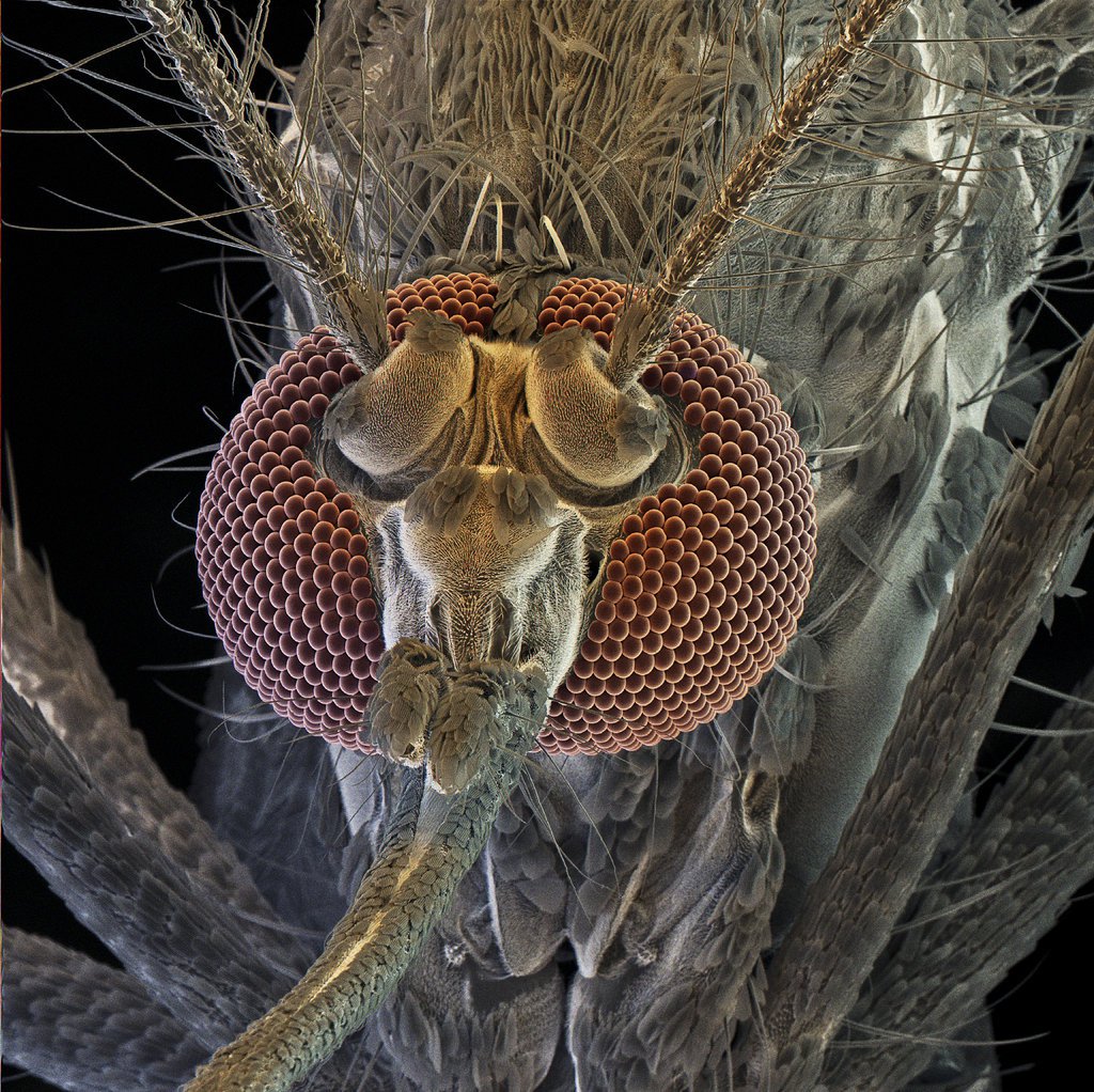 futboollever's tweet photo. 5 Reasons to Think the Zika Virus Causes Microcephaly https://t.co/N3MTPGUTOH https://t.co/XGgAwrrhvU