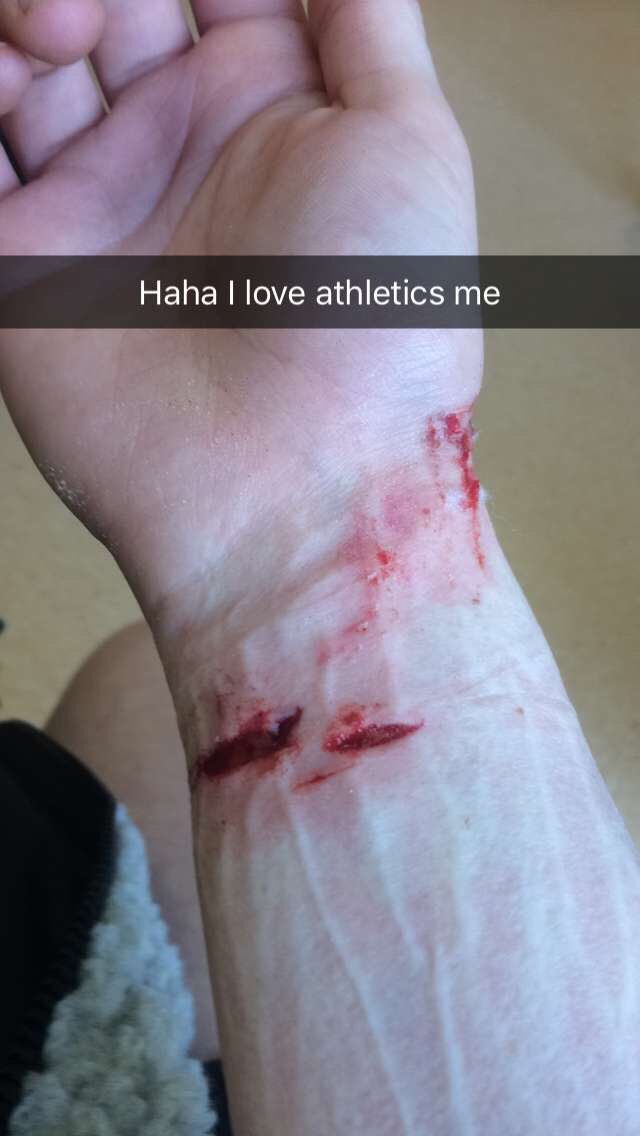 HollieProfitDJ's tweet image. So today I managed to slice my wrist open in 3 places from long jump. Like how is that even possible