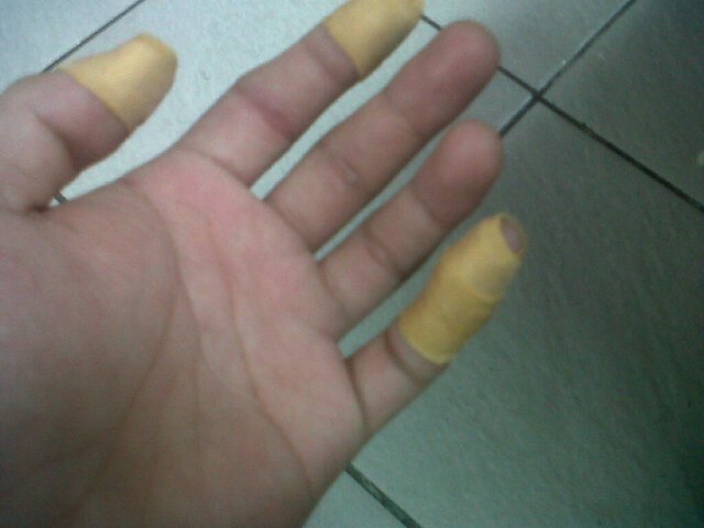 Walaupun cidera demi customer harus tetap profesional dan rasa juga harus berkelas, I'm chef I will served you