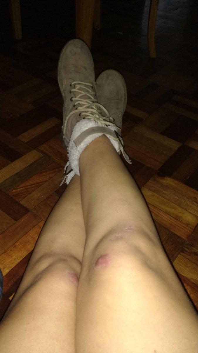 cromosniebla's tweet photo. Quiero, quiero...pero mis pies se rebelan!! https://t.co/LYhwSixNto