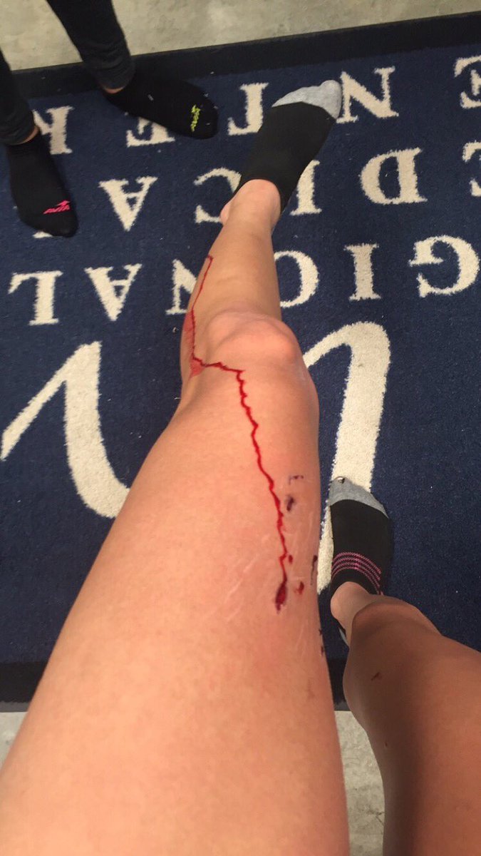 reynagarcia18's tweet photo. I swear my luck gets better and better ππππ«π«π«π« #Trackfails https://t.co/iQUhSfp5D2