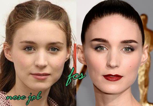 fcsurgery's tweet photo. https://t.co/P3TidscWr0
#plasticsurgery #rooneymara #empire #formationworldtour https://t.co/BfPNqVTPGm
