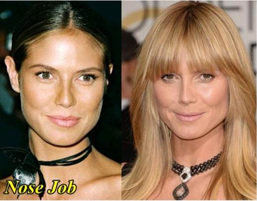 fcsurgery's tweet photo. Heidi Klum plastic surgery
https://t.co/yw1l6d0nXZ
#empire #formatioworldtour #heidiklum https://t.co/RL4jjxFhi2