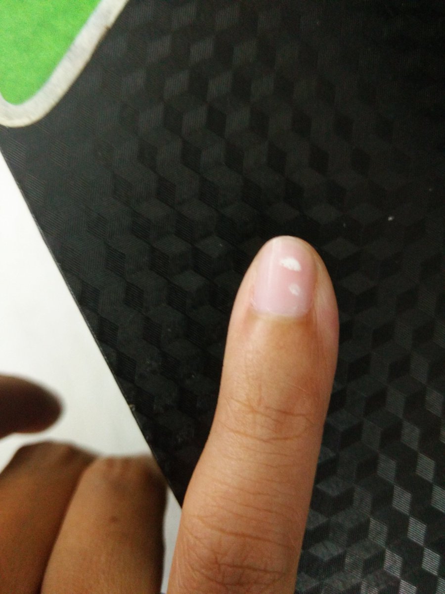atreez_sha's tweet photo. Dulu masa sekolah diorg telek bakal anak berapa ramai bila tgk ada tanda putih kat kuku .. #phui #kukutaksihat https://t.co/mjFMsmybT5