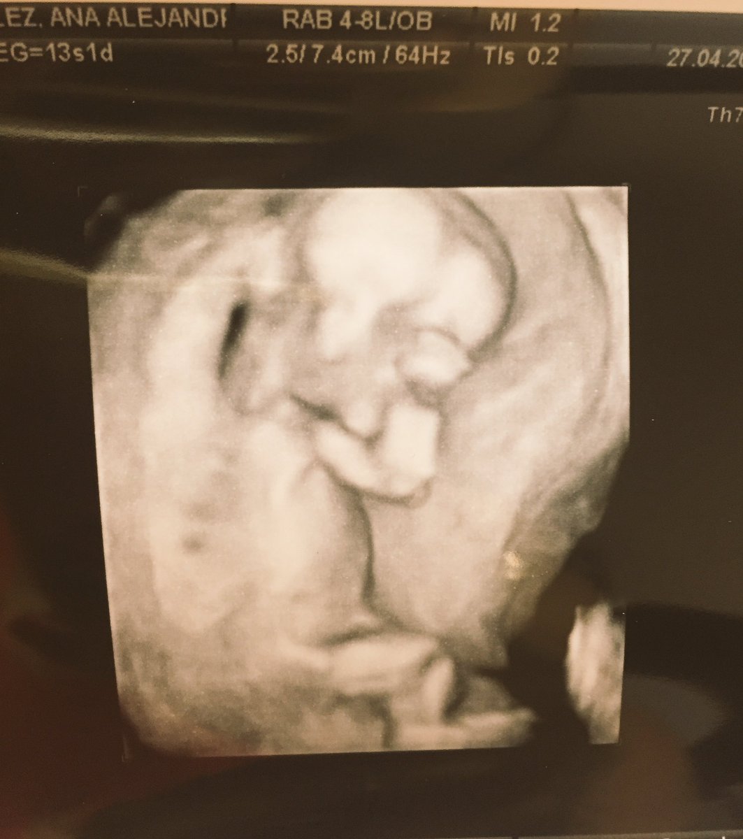 aleesanchezg's tweet photo. 😍😍👶🏼👶🏼👶🏼 mi beb@ 💕💙 https://t.co/Qc4PgEyVpD