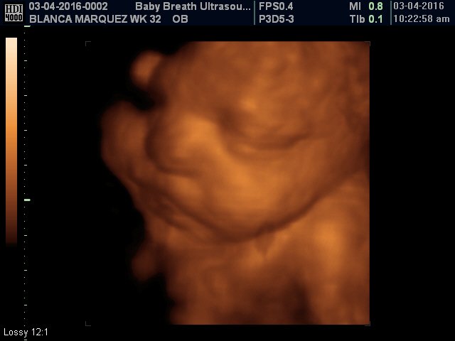 3d Baby Ultrasound breath1 Twitter