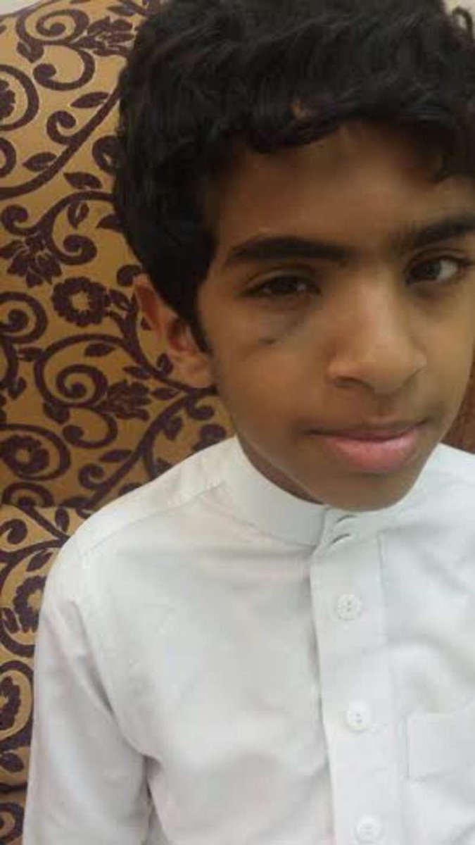 رنية.. ولي أمر يتهم معلماً بضرب ابنه ويطالب بالتحقيق والمحاسبة sabq.org/8CXpZc <a href="/sabqorg/">صحيفة سبق الإلكترونية</a>