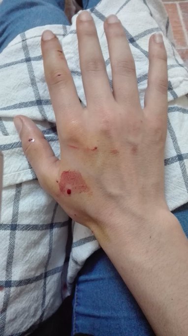 Perdonad que no este al 100% estos dias. He tenido un accidente gatuno... Nada grave. https://t.co/G<a href="/tag/fan"class="tags"><span>#fan</span></a>