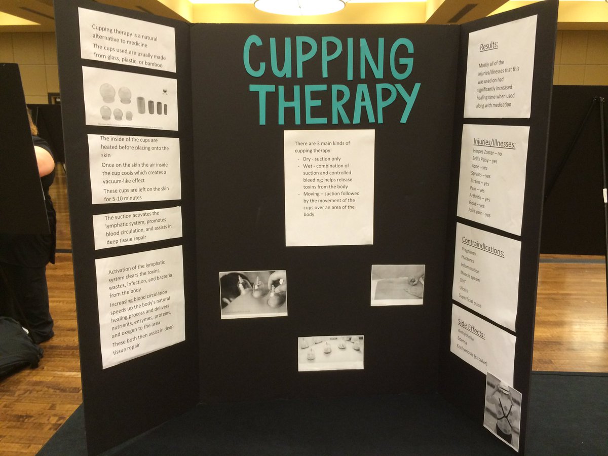 ESU_ATProgram's tweet photo. AT Student poster presentations at #ResearchAndCreativity Day! #StingersUp https://t.co/Kt0xBohI7F