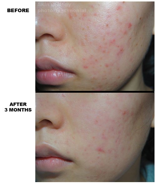 SkinBiology's tweet photo. CHANGE the look of your skin! 1-800-405-1912 for FREE sample with purchase
#freesamplesuk #productreview #bbloggers https://t.co/W29PUnrFel