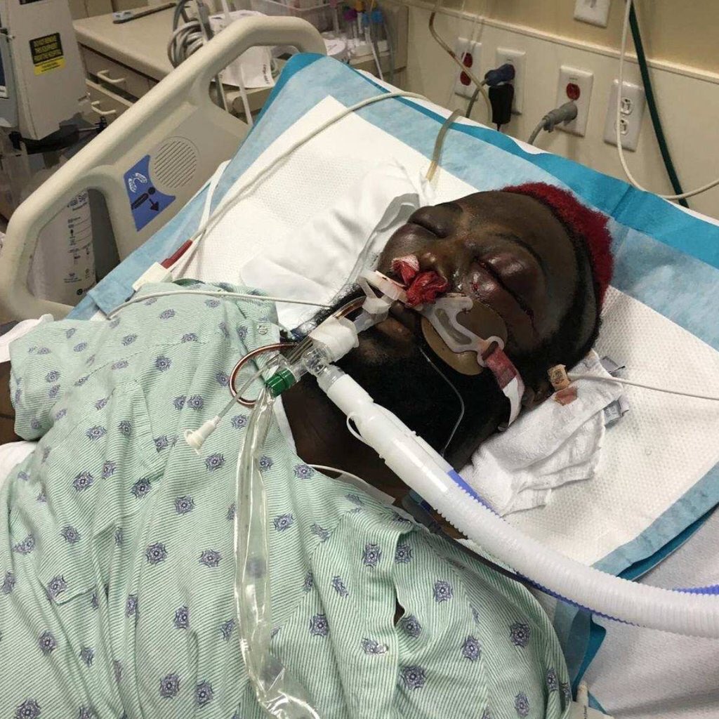 ScrapObama's tweet image. Damn! Look what @KimboSlice did to DADA 5000. #GOAT