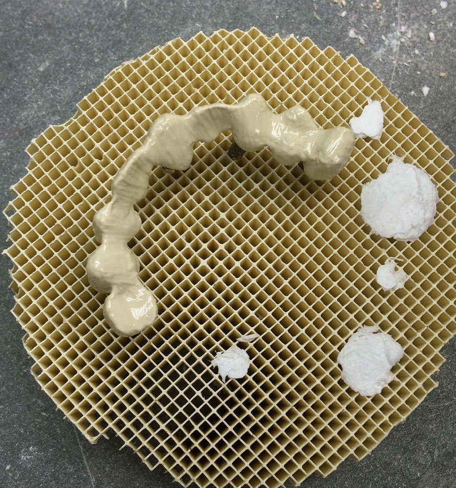 PoseyDentalLab's tweet photo. #PFM bridge in progress at the opaque stage. #poseydentallab #dental #dentistry #dentallab #dentaltech #dentalwork https://t.co/juktVLyq6k