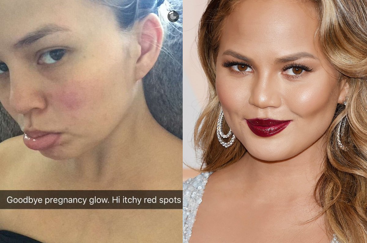 tresbcom's tweet photo. #ChrissyTeigen y otras modelos que lucen muy diferentes sin #maquillaje 💅💄 https://t.co/ANpCRCTAfX https://t.co/Odvb3rGlxM