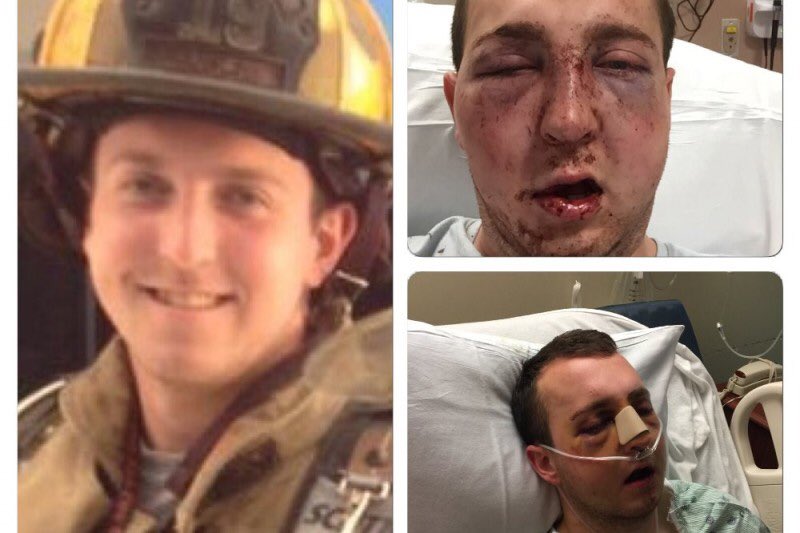 firesuccessbook's tweet image. Brandon is a reserve FF at my FD. He was brutally assaulted &amp;amp; needs help.

Please donate.

gofundme.com/2mfhzdgk?utm_s…
