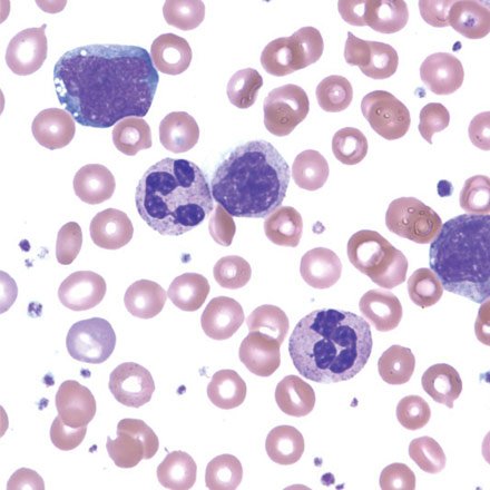 Pathologists's tweet photo. Have you posted your #Labfie yet this #Labweek? https://t.co/VppepBVMr7
