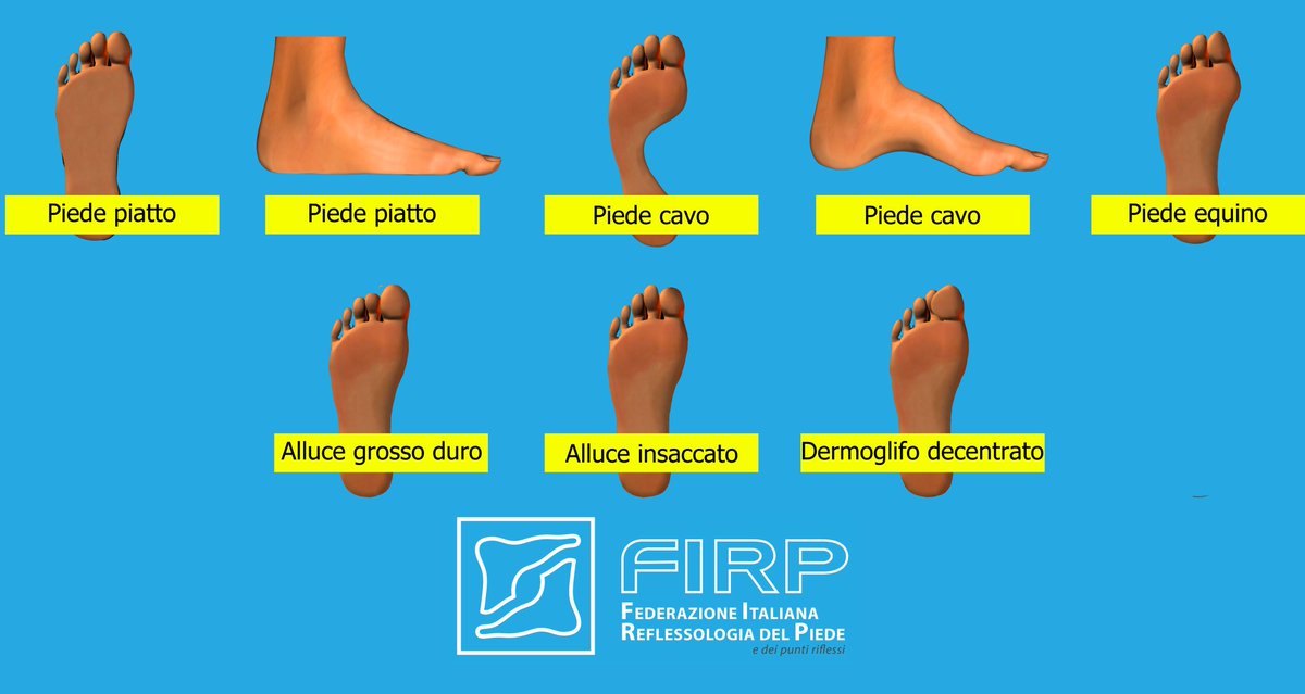 FIRP1984's tweet photo. Come riconoscere differenti tipi di piedi.
How to recognize different kind of foots.
#riflessologiaplantare https://t.co/YajLt15g6Y