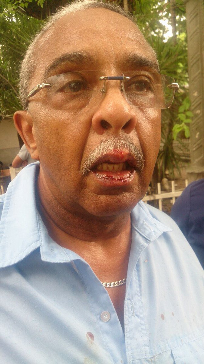 gislenyblanco's tweet image. Dr Jose Trujillo diputadoAN emboscado golpeado dirección HCM por esbirros d Luis López  ptecorposalud @la_patilla