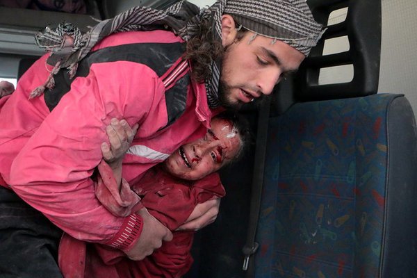 TurkmanDagi's tweet photo. Ümmetin yetimleri kan ağlıyor! Kaç çocuğun daha annesiz babasız kalması lazım, zulüm'ün bitmesi için? #Suriye #Syria https://t.co/x5jxsJZKYQ