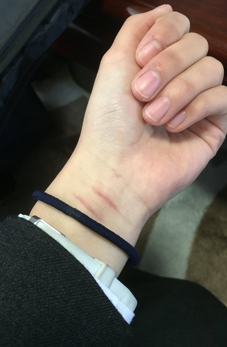青いブレスレット運動 青いブレスレット運動 自傷画すみません 学校行くときは紺色のゴムつけてます 1人じゃないよ 黒兎