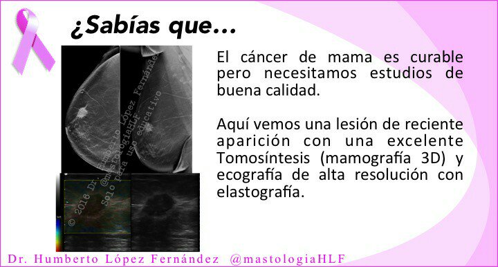mastologiaHLF's tweet photo. Si diagnosticamos y tratamos precozmente, el #CáncerDeMama es curable.  Debemos exigir imágenes de calidad https://t.co/fBkyBdin72