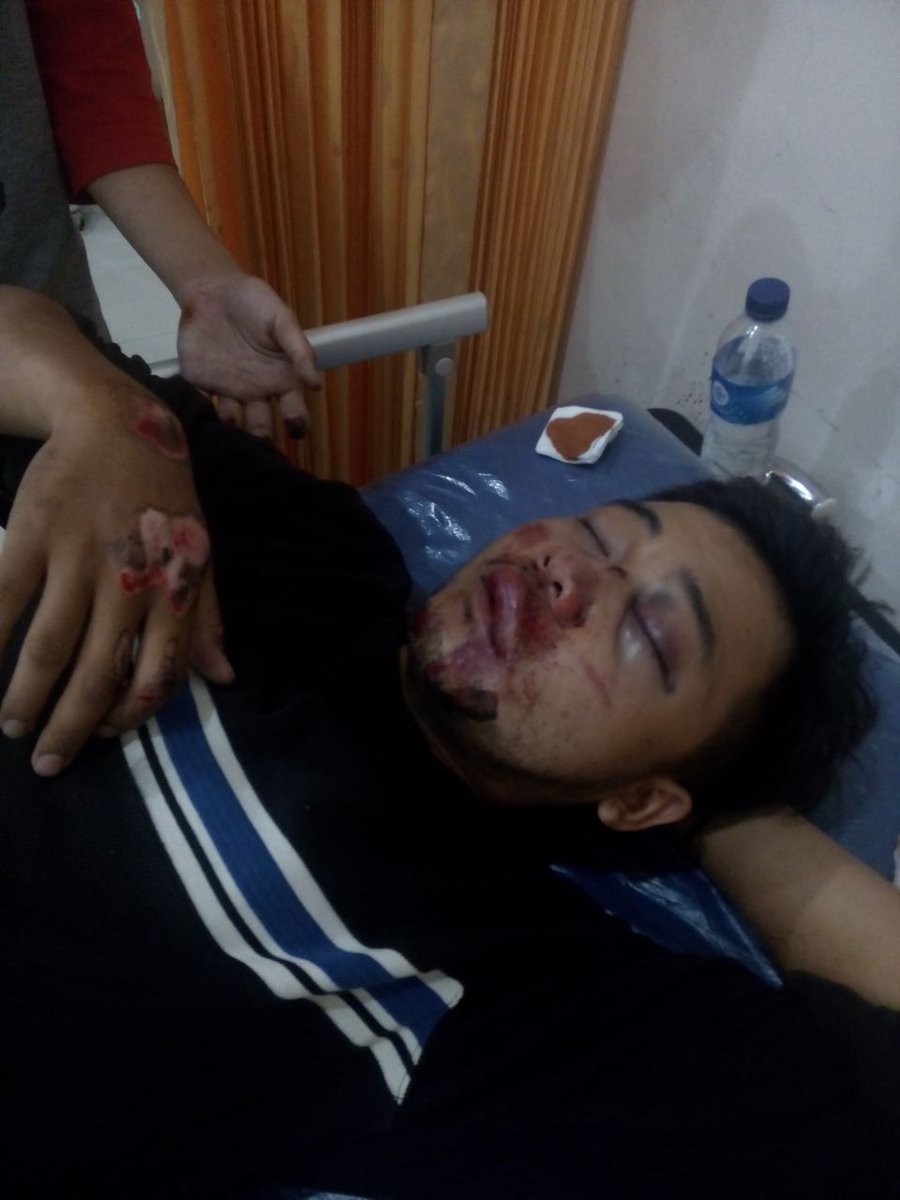 Riki_St0nesWay's tweet photo. Kang @ridwankamil saudara saya d begal jam 4 subuh tadi d daerah jembatan stm 5, begal masih keliaran d luar kang https://t.co/WLUvnhMMH2