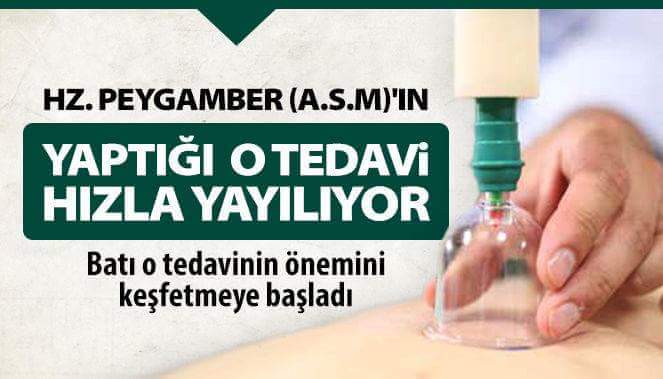 HacamatcM's tweet photo. Hacamat randevu : 05342678056 https://t.co/iOmc5ziL8u