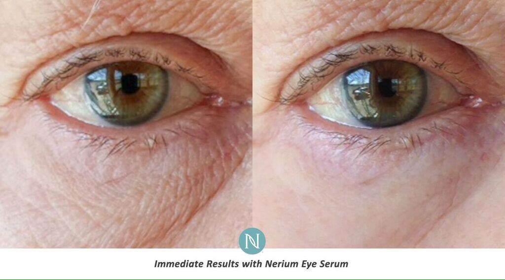 GetEcigsFree's tweet image. Nerium Eye Serum works like a boss! whatisneriumad.com