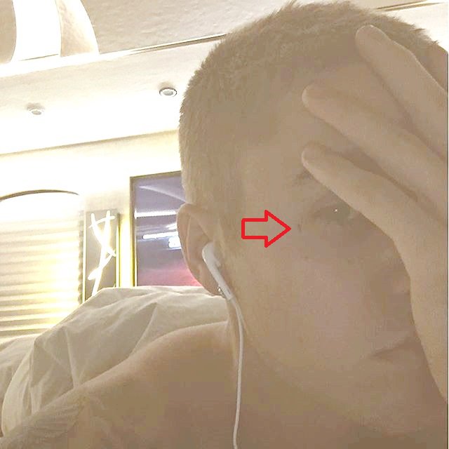 frontrowjp's tweet photo. ジャスティン・ビーバーが目尻に小さな十字架のタトゥーを入れた。2月に顔にタトゥーを入れるかどうかをGQ誌に聞かれ「40か50代になったらかな」と言っていたが、待てなかったよう。©Instagram/Justin Bieber https://t.co/FssFVnXej2