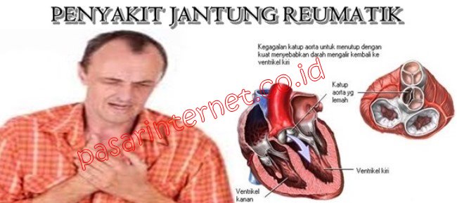 Penyakit Jantung Reumatik