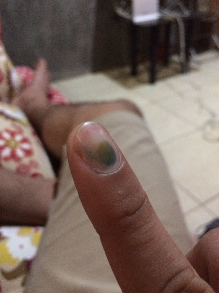 iammegoi's tweet photo. Waiting for the result..!  #DUCAY2016 #changeiscoming #Election2016 https://t.co/mN7seWfu4Y