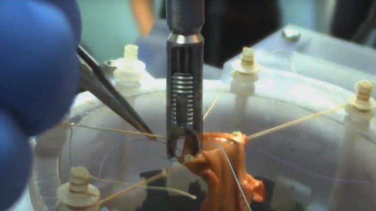 Adam__Davie's tweet photo. Robot Outperforms Human Surgeons In Pig Gut Op #think3000 #tech #surgery #roboticsurgery https://t.co/aYPTFq59jk https://t.co/X9tB7GxTX3