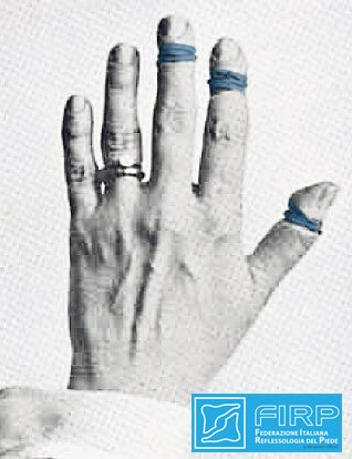 FIRP1984's tweet photo. Una bellissima testimonianza degli esperimenti  compiuti dal Dr  Fitzgerald  fondatore della reflessologia zonale. https://t.co/w2p1J36Bk3