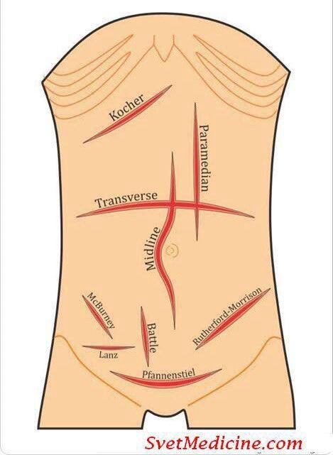 k8_quinn's tweet image. Looking at Jon Snow&apos;s incisions like &quot;damn that&apos;s a mighty fine McBurneys&quot; #PAschoolproblems