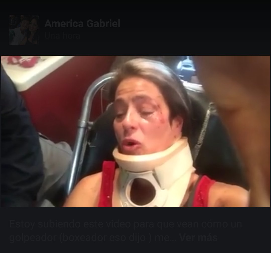 Navarro_Hector's tweet photo. La actriz @americagabriell fue golpeada por este tipo en el Parque México por pedirle levantará 'popo' de su perro https://t.co/p23G04FBmt