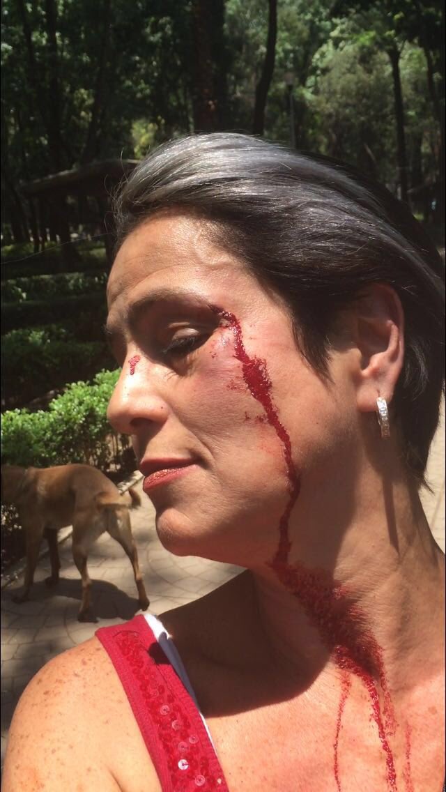 SusanaHerediaT's tweet photo. @ZabaVengadora este es #LordPopo y estrelló su bici contra @americagabriell https://t.co/5IiGFX1IV4