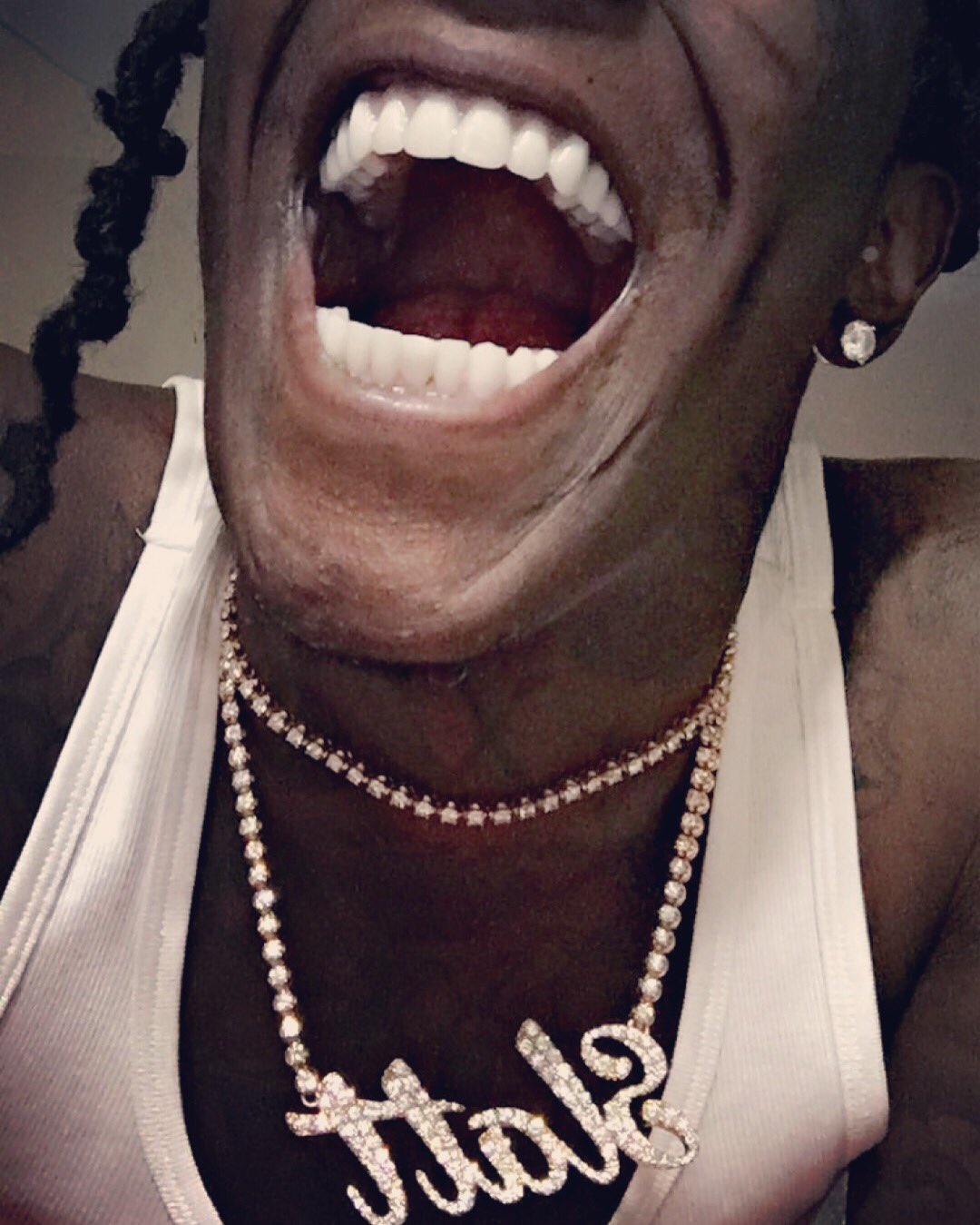 Young Thug Real Teeth