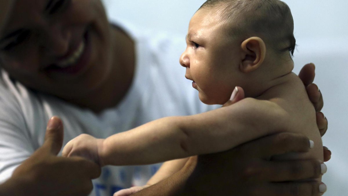 hsfi's tweet photo. Lääkärit BBC:lle: Zikaviruksen riski luultua suurempi #zikavirus https://t.co/m5gZRz7xay https://t.co/IiCgW4BRt4