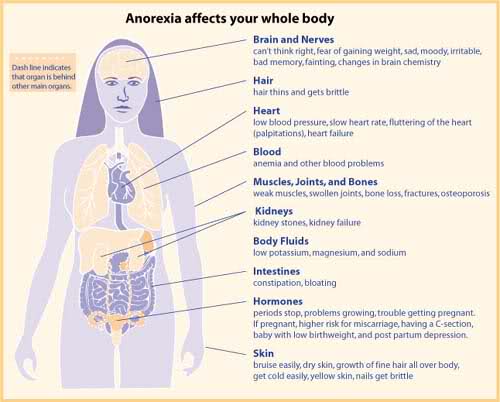DANZAANORESSIA's tweet photo. #ANORESSIADANZA I DISTURBI DI UNA SCARSA #ALIMENTAZIONE: RISCHI PER IL #CORPO #DANZA #BALLERINI #BALLETTO #ANORESSIA https://t.co/enzVEEexK0