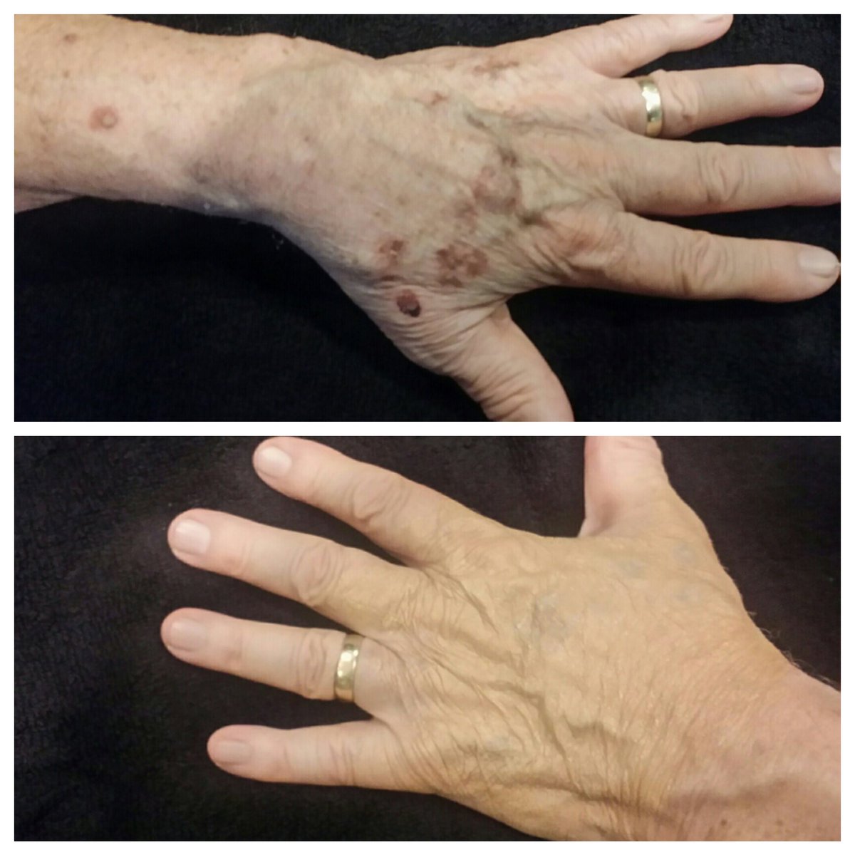 How to Apply Westmore Beauty Body Coverage