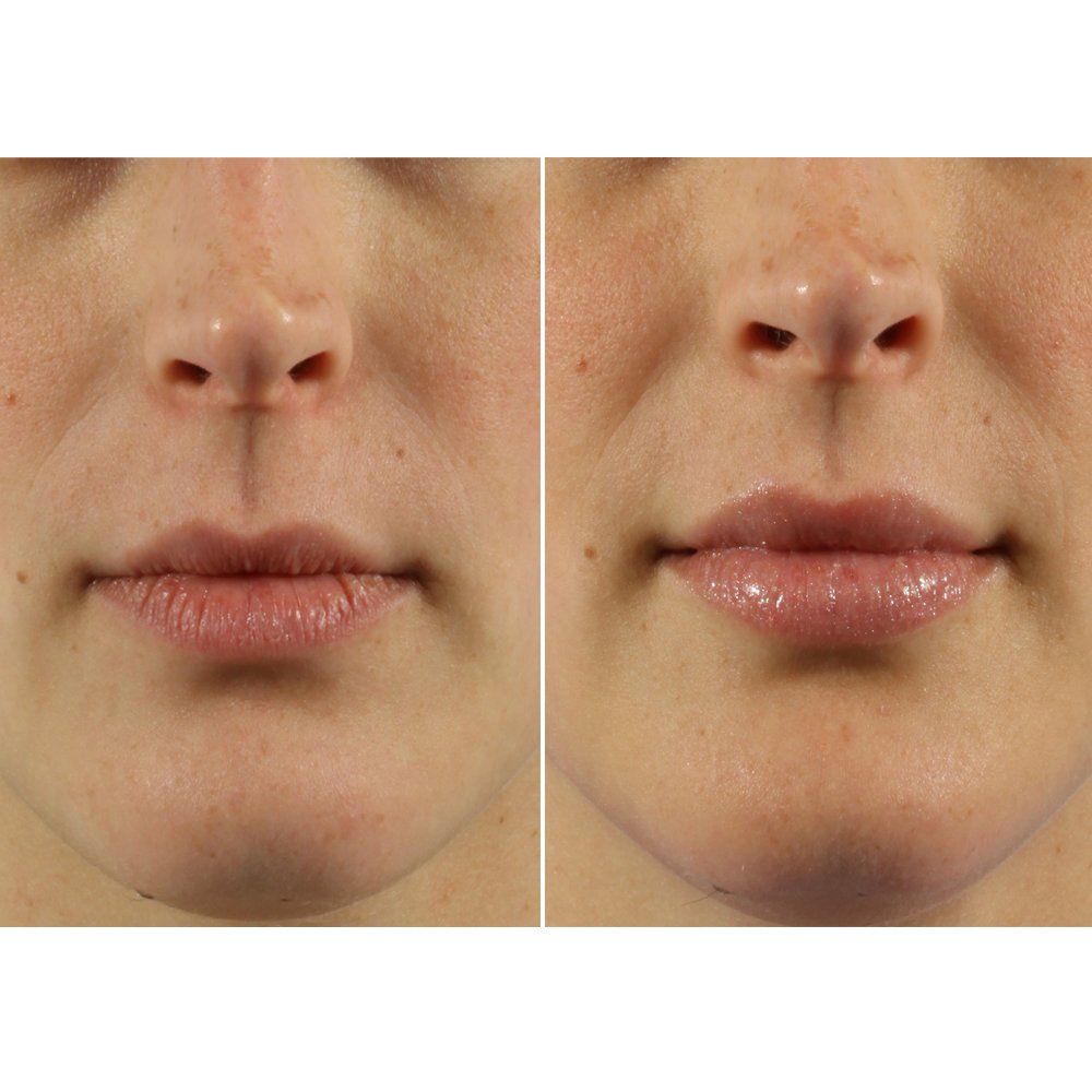 NewBeauty's tweet photo. The most effective ways to get a plumper pout at any age: https://t.co/355Nys315A https://t.co/zAkXnMNYaG