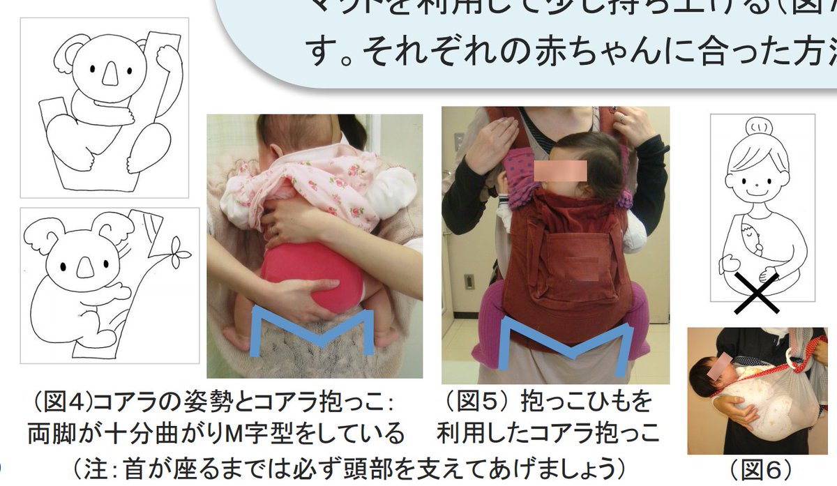 全国に広がってほしくない「首が座っていない乳児でのベビースリング横抱き」 股関節脱臼 Togetter