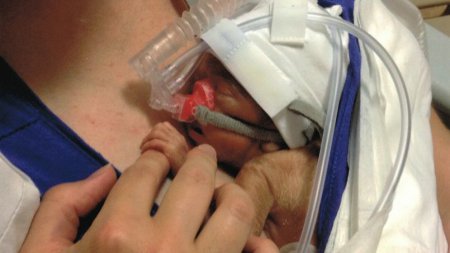 #Prématurité : 22% d'augmentation entre 1995 et 2010 selon <a href="/SOSPrema/">SOS Préma</a> >>bit.ly/21szTA9